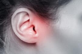 Jak działać w przypadku uciążliwego świądu uszu?