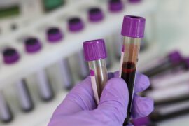 Krew w próbce do przeprowadzenia badania biochemicznego