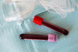 Trombocyty (płytki krwi) – normy. O czym świadczy zbyt wysoki lub zbyt niski poziom trombocytów?