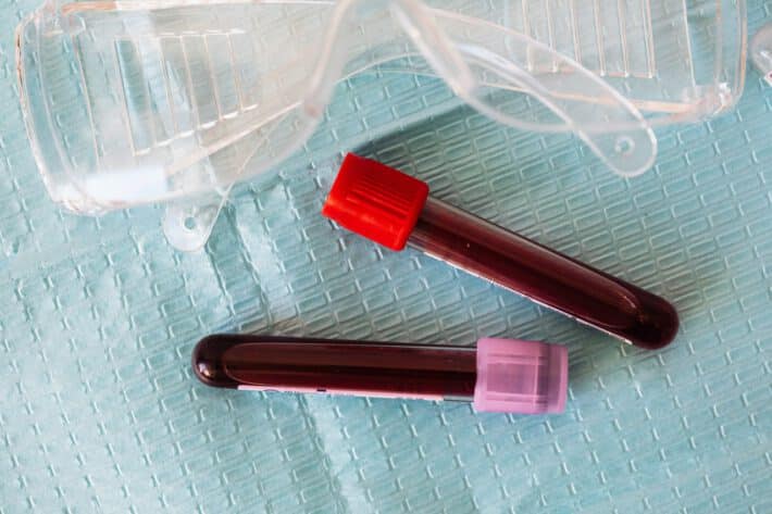 Badanie poziomu trombocytów z krwi