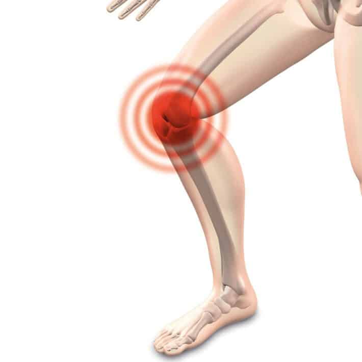 Ból stawów w kolanie jako możliwy objaw reumatyzmu