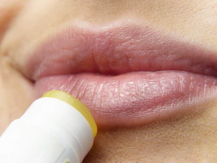 Kobieta dbająca o higienę ust podczas opryszczki na ustach