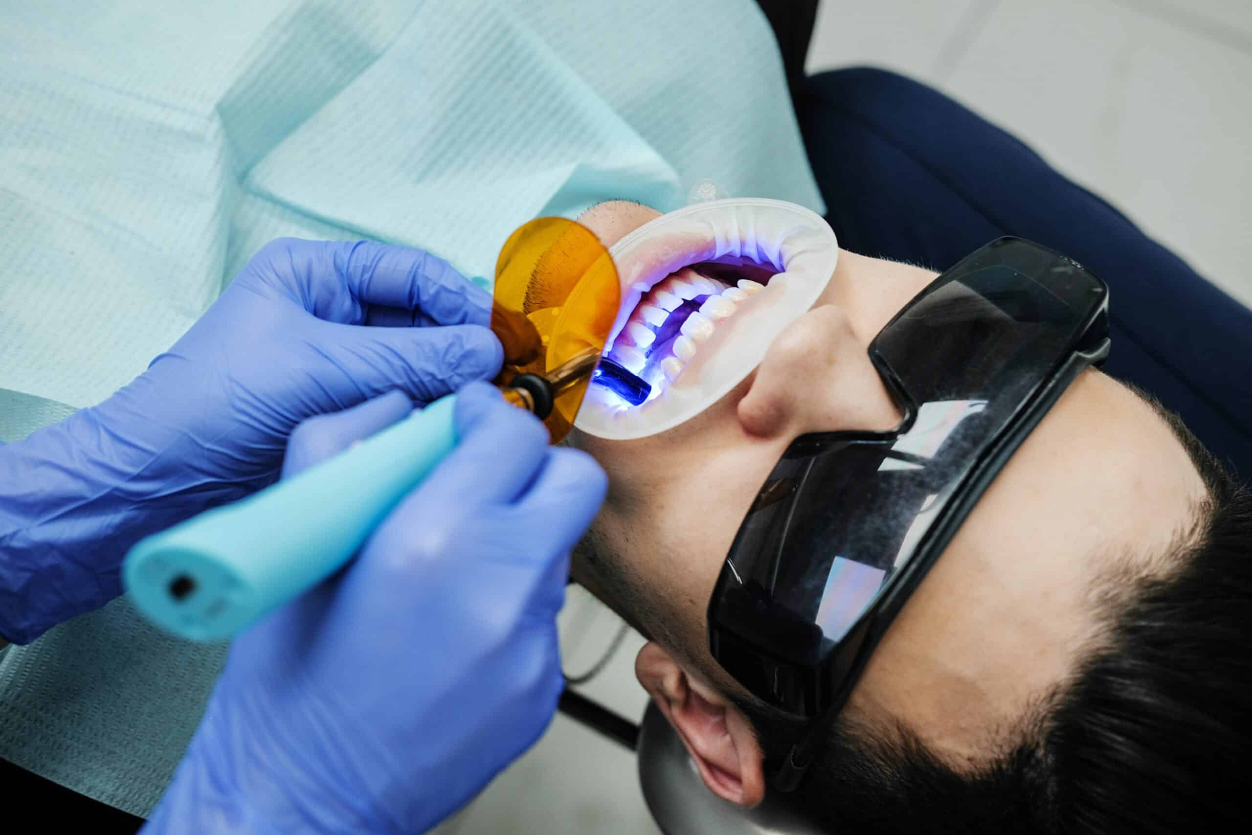Wybielanie zębów w gabinecie stomatologicznym