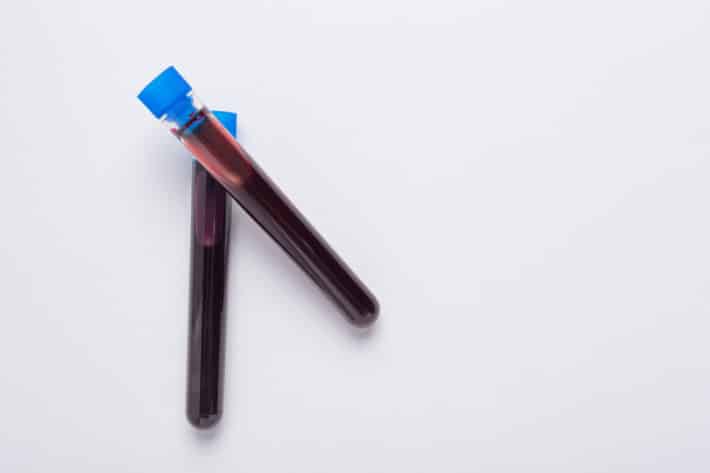 Test z krwi