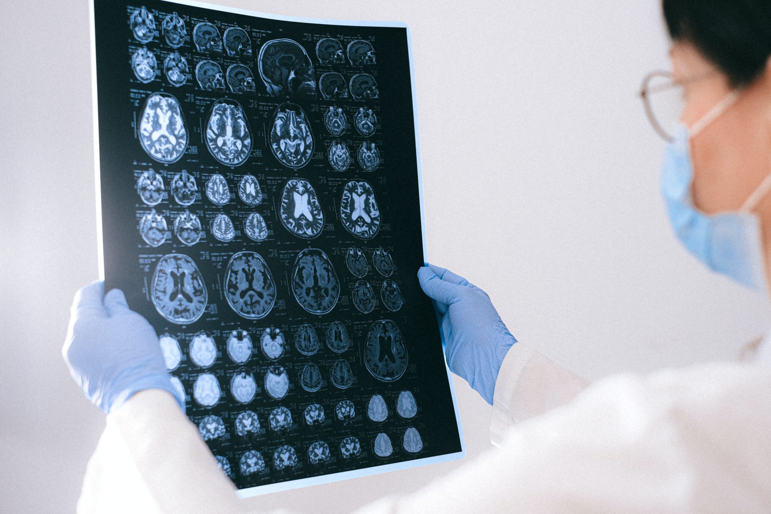 Lekarka ze zdjęciem rentgenowskim guza mózgu