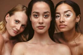 Trzy dorosłe kobiety mają na twarzy trądzik