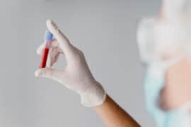 Badanie RDW CV wykonywane z krwi, którą kobieta trzyma w próbówce