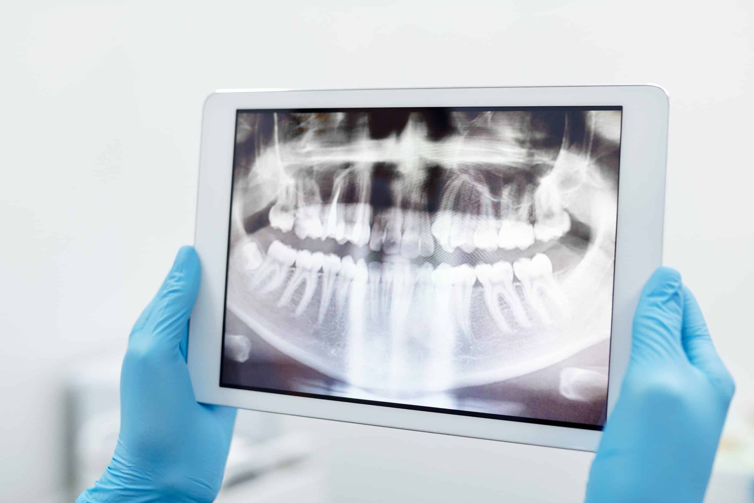 Dentysta w Wąbrzeźnie – endodoncja