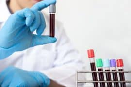 Badania krwi - dlaczego warto regularnie je wykonywać?