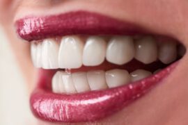 Odbudowa uzębienia - implanty zębów w Krakowie