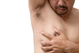 Obrazek przedstawia męską klatkę piersiową z krostkami na sutkach, które mogą być wynikiem różnych czynników, takich jak trądzik lub łojotokowe zapalenie gruczołów sutkowych. Krostki te mogą powodować dyskomfort i zmartwienie, jednak odpowiednia pielęgnacja i leczenie mogą pomóc w ustąpieniu objawów. Pomimo obecności krostek, męska klatka piersiowa wciąż emanuje siłą i męskością